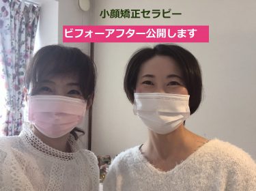 【小顔矯正ビフォーアフター】むくみがスッキリ⭐︎小顔矯正サロン旭川ライフデザイン 大上奈美